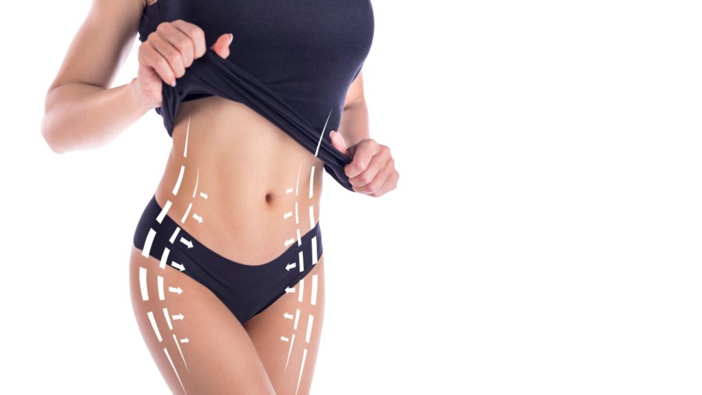 liposuction treatment
