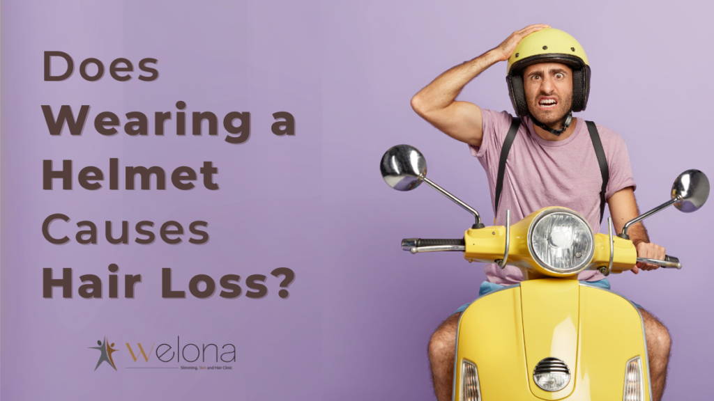 To Wear Or Not To Wear Helmet