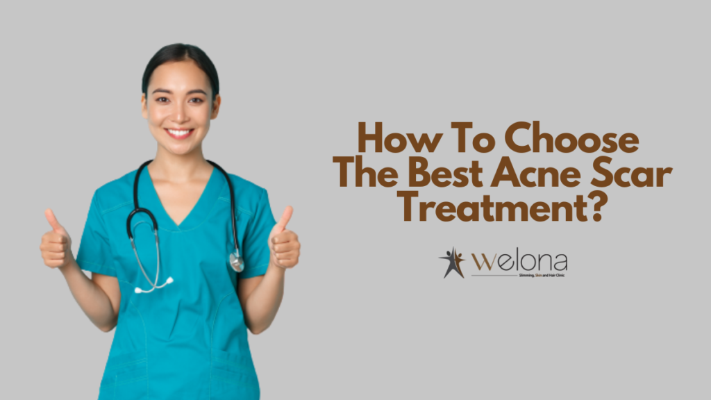 choose the best acne scar treatment