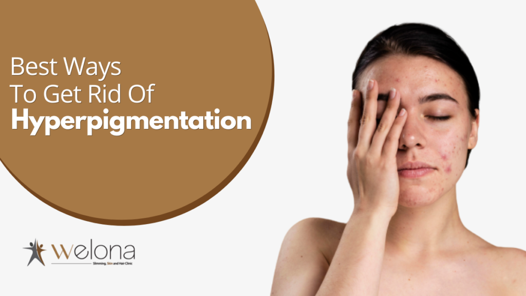 Pigmentation removal treatment