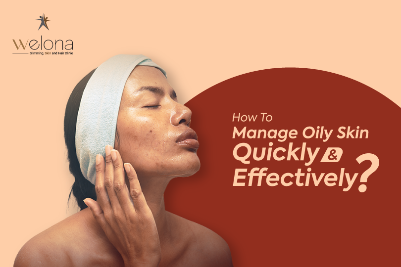 Manage Oily Skin Effectively