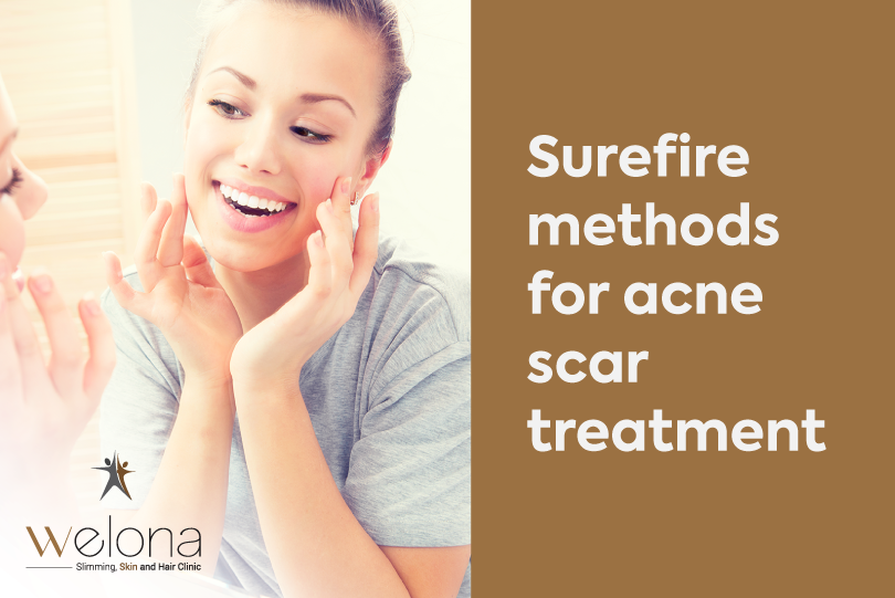 Sure-fire methods for acne scar treatment