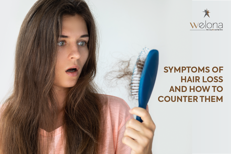 Symptoms of Hair Loss And How To Counter Them