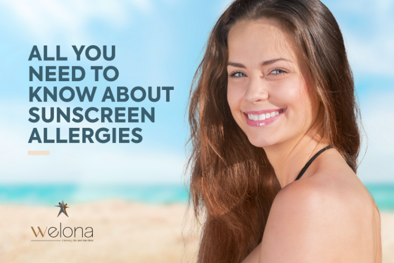 All You Need To Know About Sunscreen Allergies Explore It