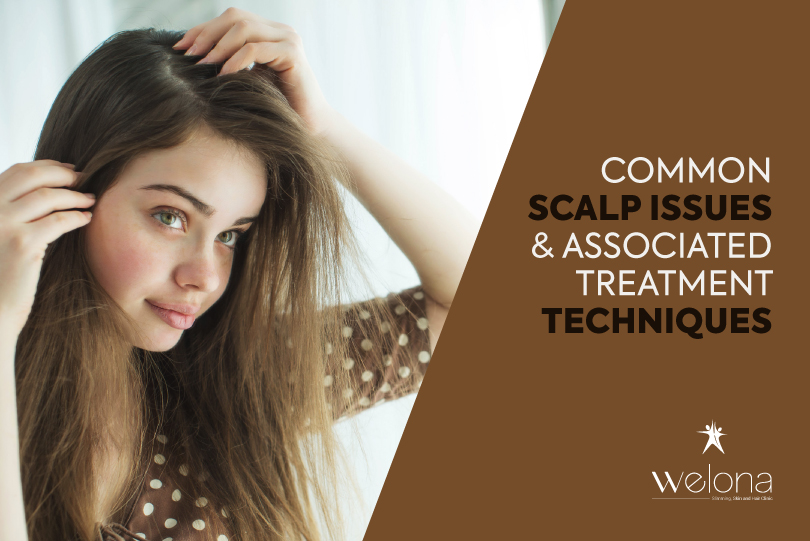 3 Common Scalp Issues And Associated Treatment Techniques