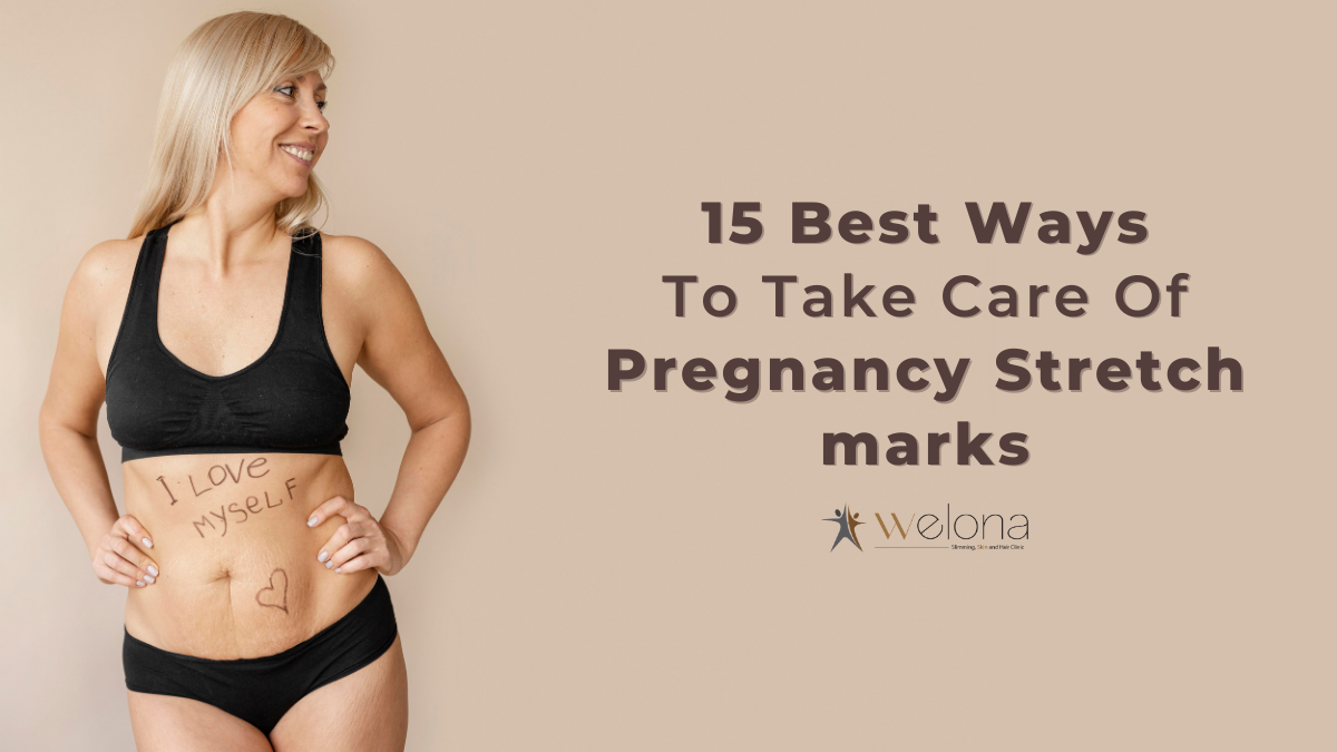 15 Best Ways To Take Care Of Pregnancy Stretch Marks