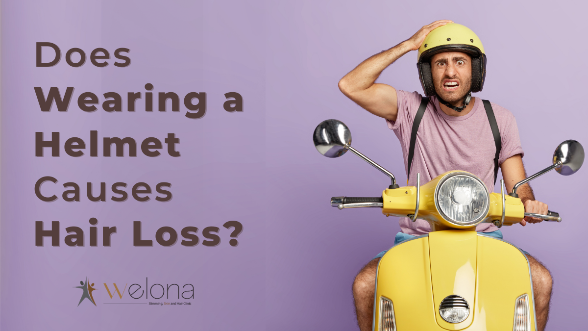 Does wearing a helmet cause hair loss?