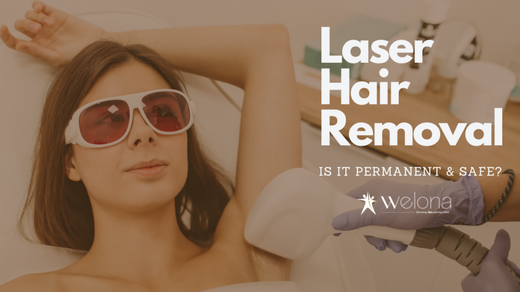 Laser Hair Removal Is it Permanent and Safe? Welona