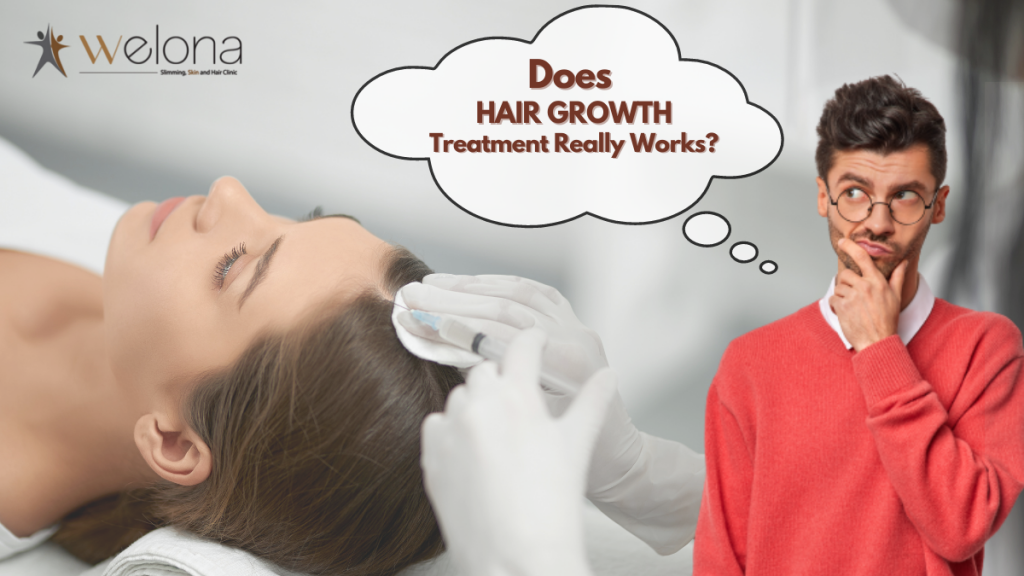 Do Hair Growth Treatments Really work? Welona