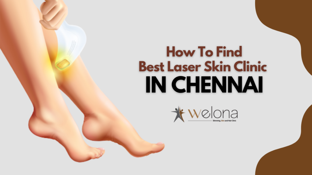 How to Find the Best Laser Skin Clinic In Chennai Welona