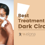 best dark circle treatment chennai