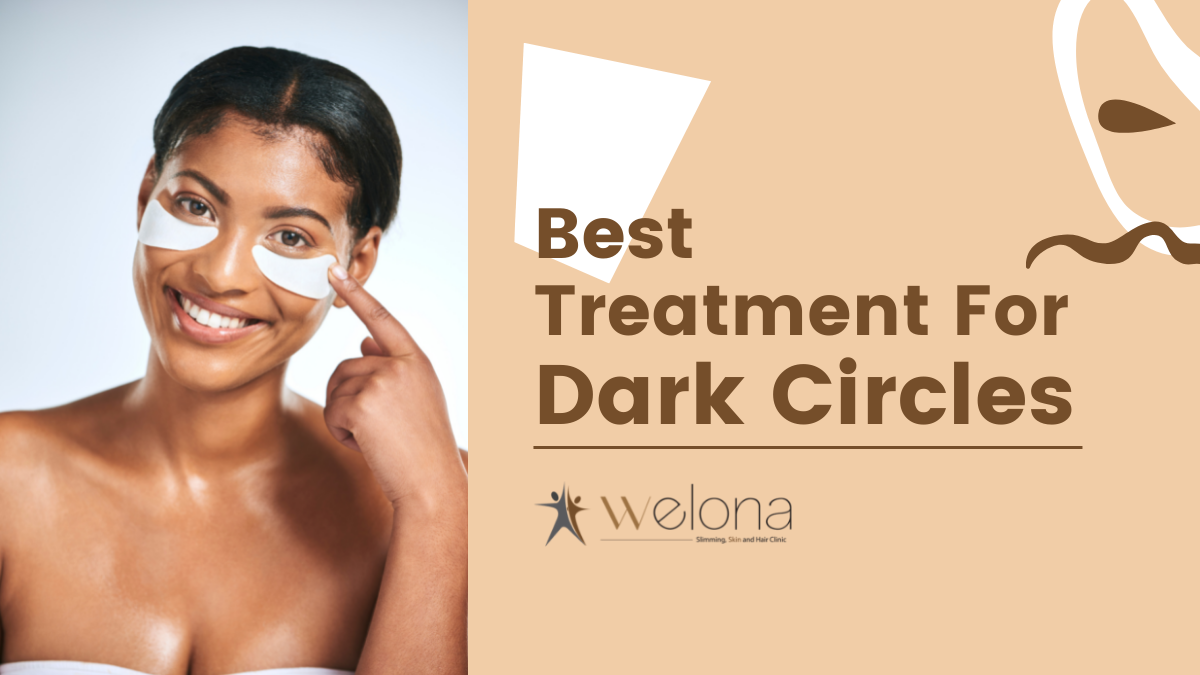 Best Ways to Treat Dark Circles