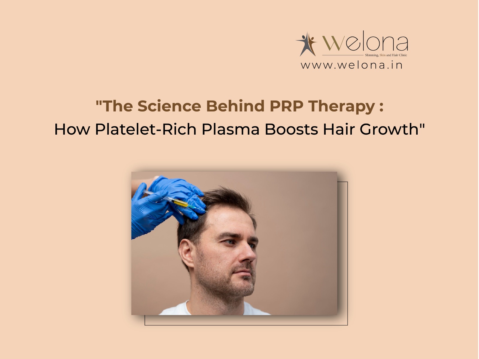 ​​The Science Behind PRP Therapy: How Platelet-Rich Plasma Boosts Hair Growth