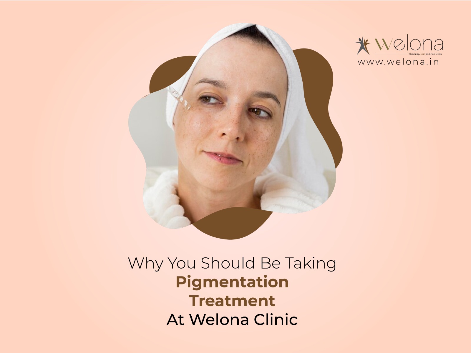 6 Pigmentation Treatment At Welona For a Flawless Skin