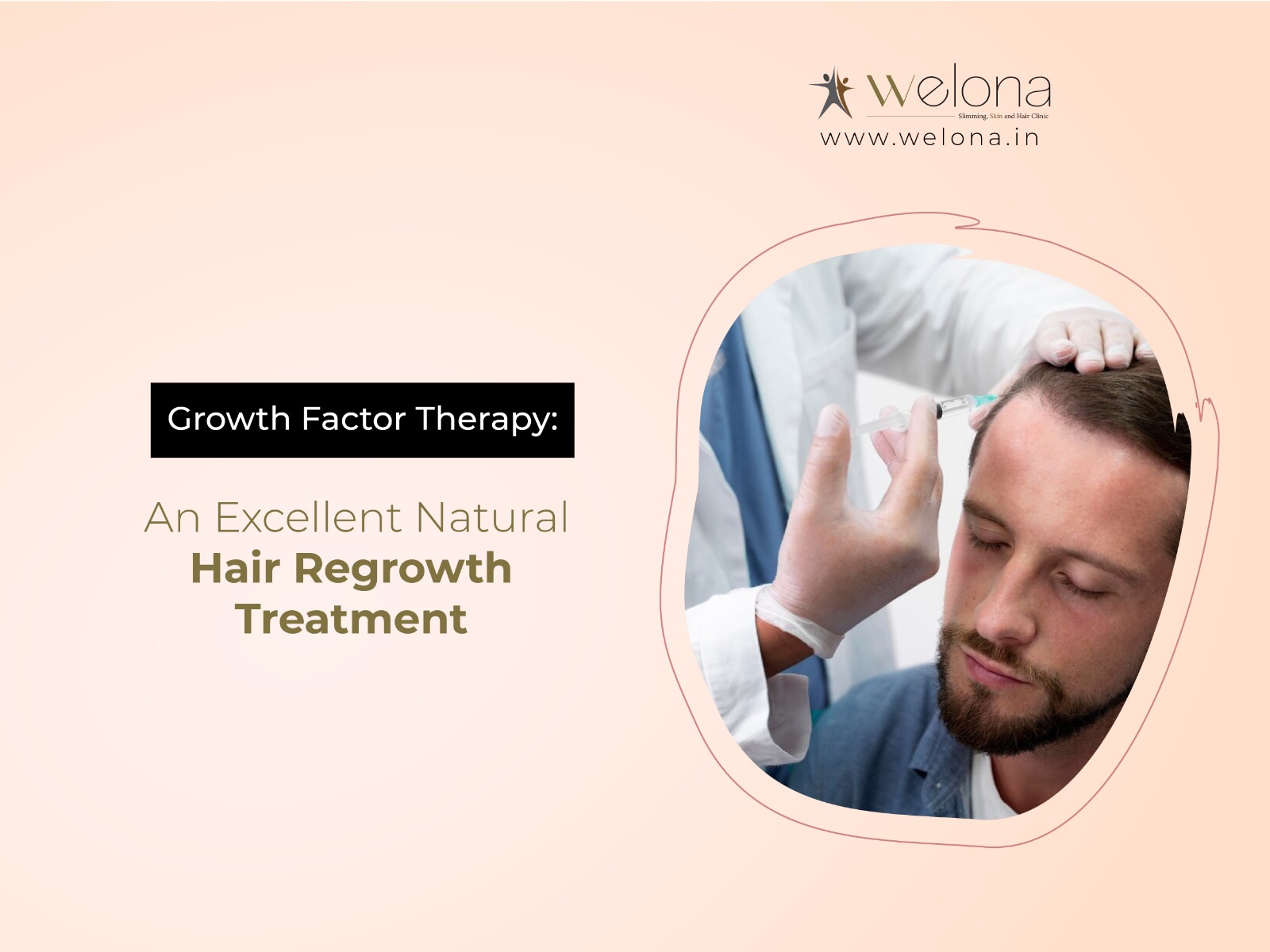 GFC Therapy: An Excellent Natural Hair Regrowth Treatment