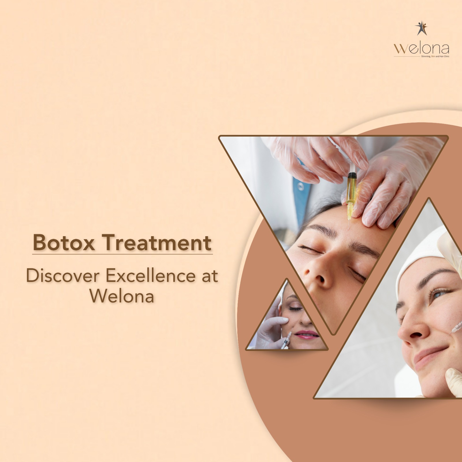 Botox Treatment: Discover Excellence at Welona