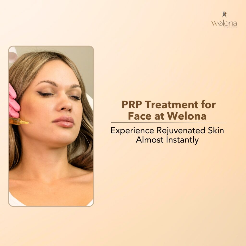 PRP Treatment for Face at Welona Experience Rejuvenated Skin Almost