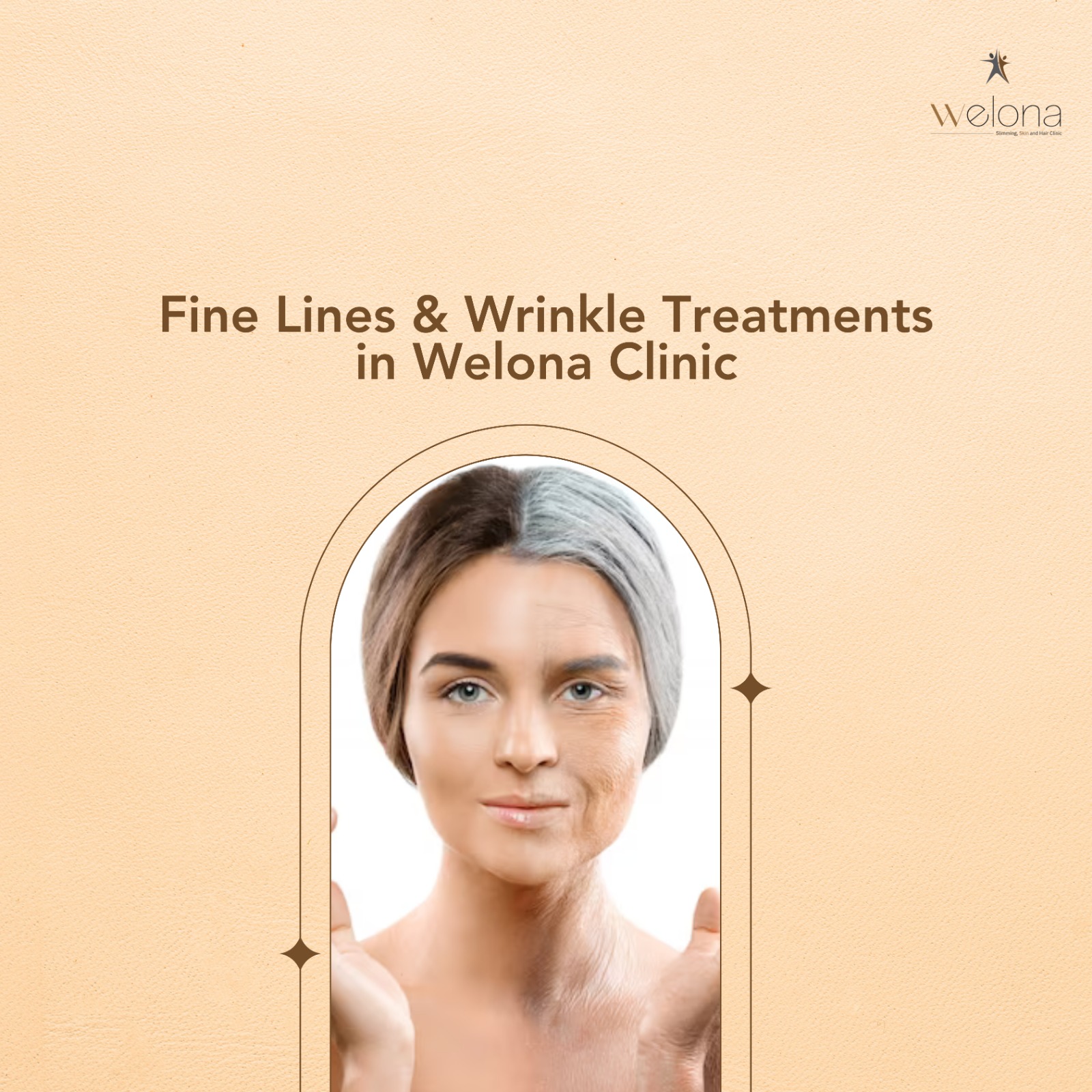 Fine Lines & Wrinkle Treatments in Welona Clinic