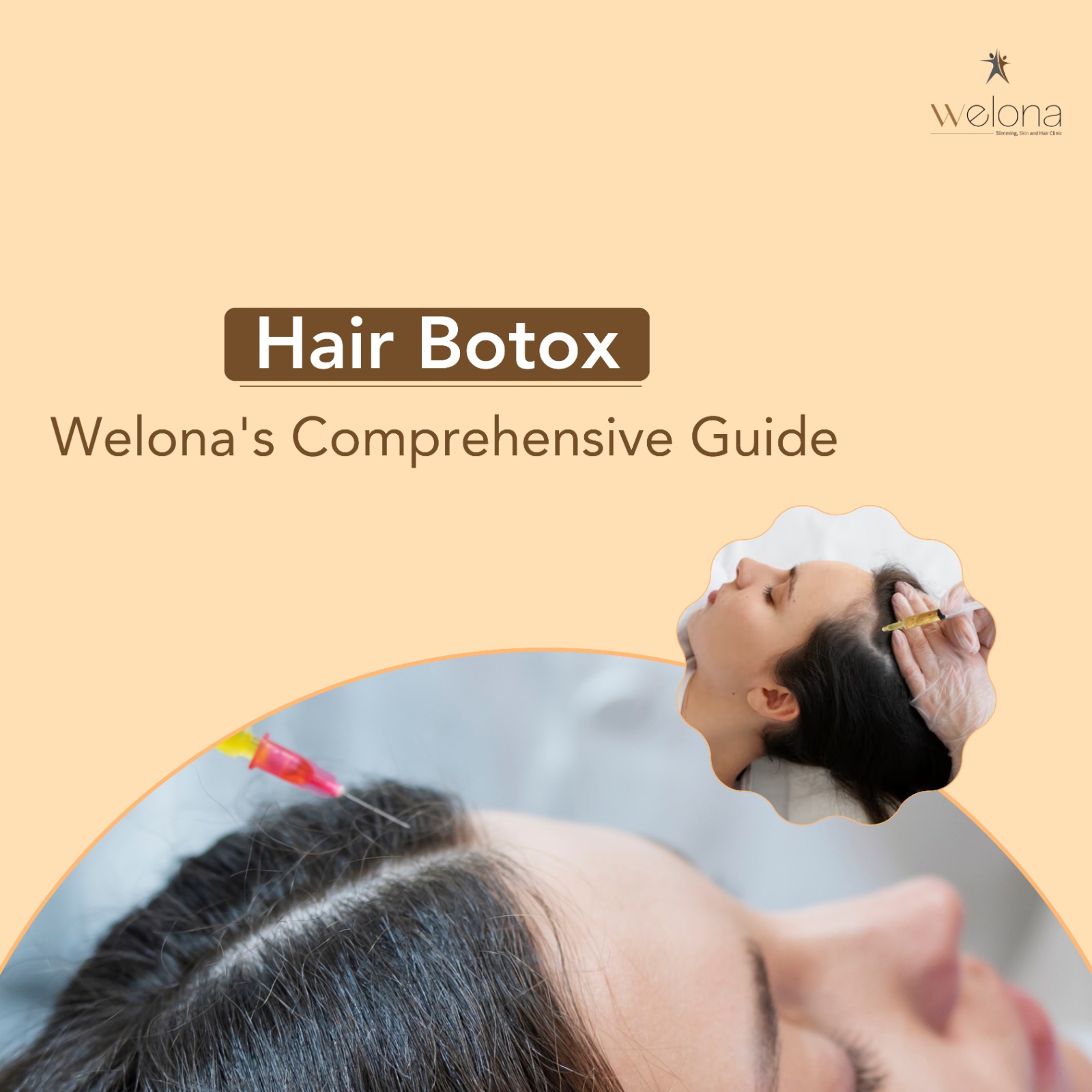 Hair Botox: Welona’s Comprehensive Guide