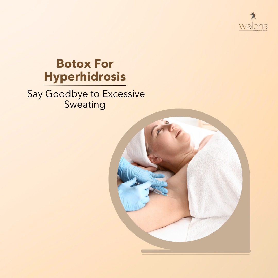 Botox For Hyperhidrosis: Say Goodby to Excessive Sweating