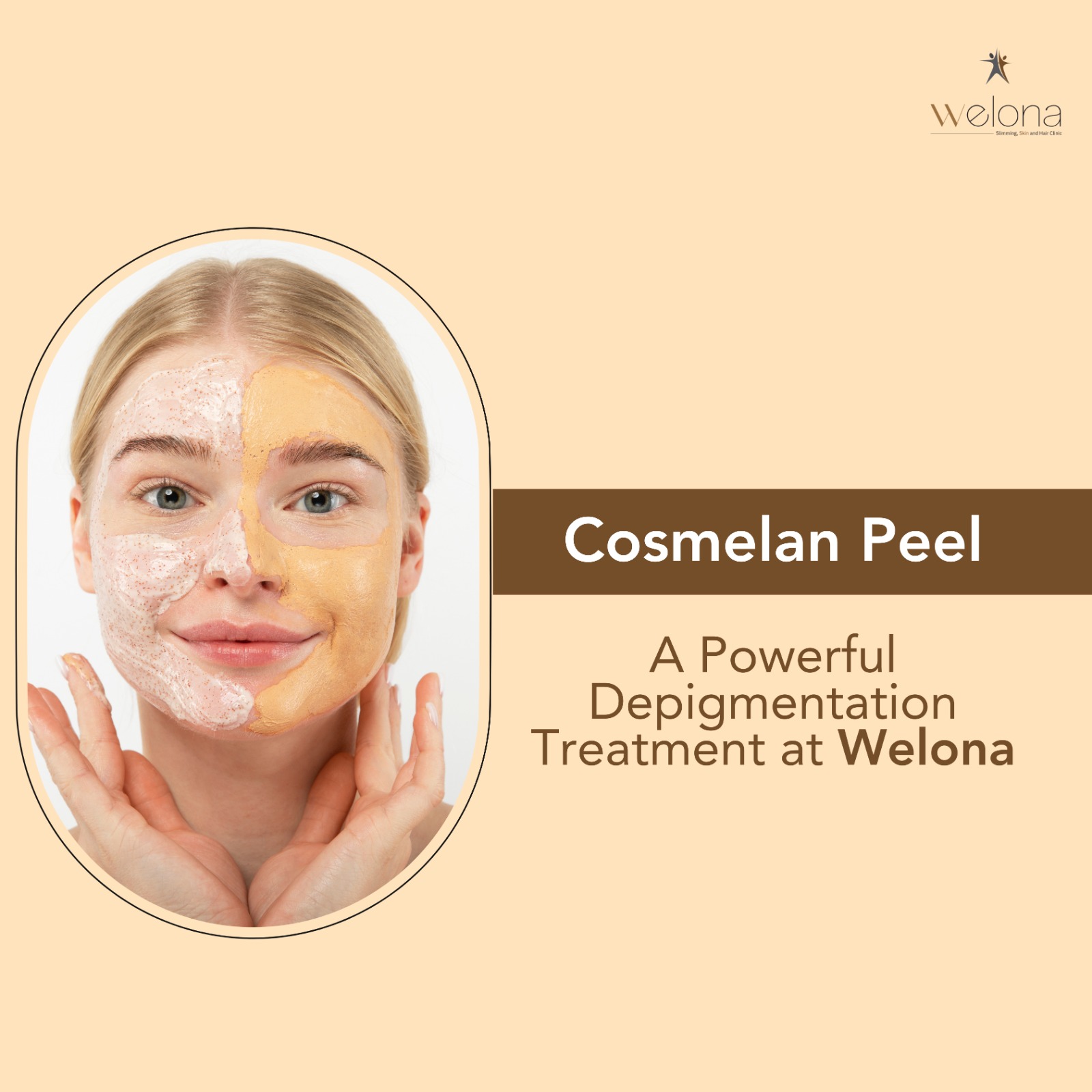 Cosmelan Peel: A Powerful Depigmentation Treatment at Welona