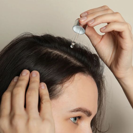 How to Prevent and Manage Hair Loss