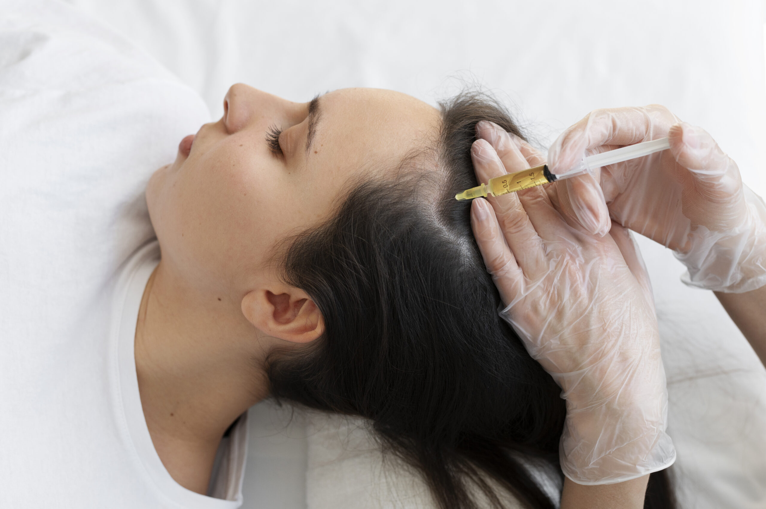 prp hair loss treatment