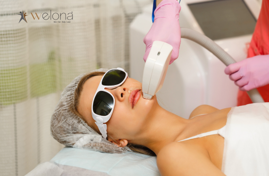 Everything You Need to Know Before Your First Laser Hair Reduction in Chennai