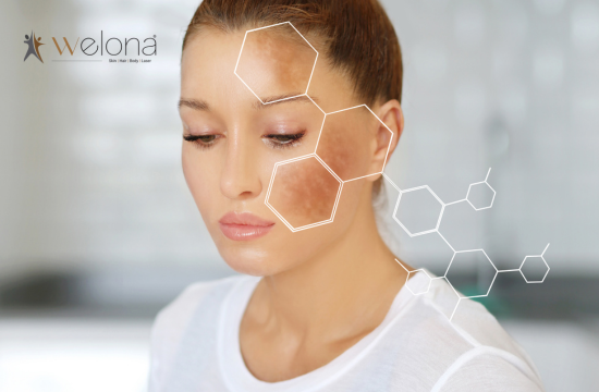 Can Acne Scars Be Removed Completely. Explains our dermatologist.